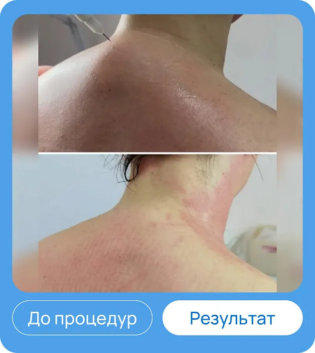ЭХВЧ МТУСИ-50 обновленный