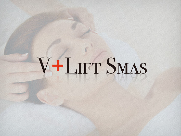 MBT V-LIFT SMAS