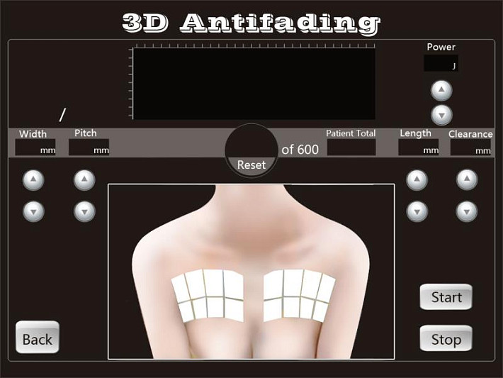 4D HIFU