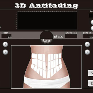 4D HIFU